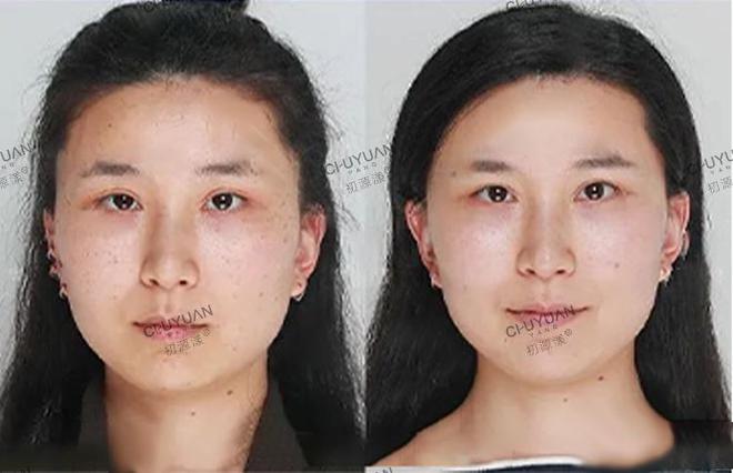 佛山美容护肤热门榜单TOP10，打造你的肌肤之选